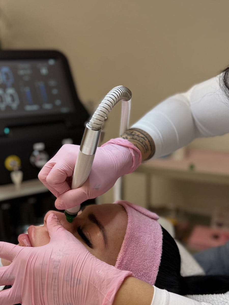 AquaFacial-Behandlung in der Ästhetikoase — Tiefenreinigung & Hydratation