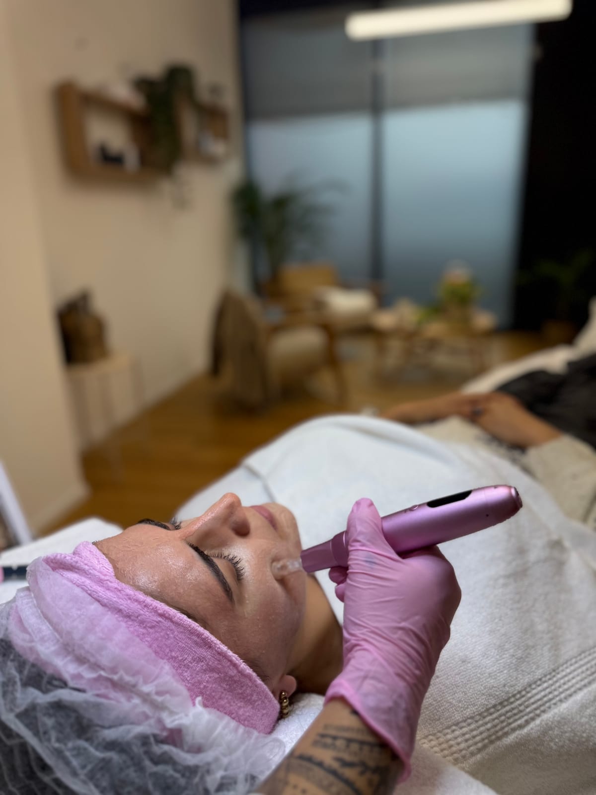 Microneedling — Kollagen-Stimulation